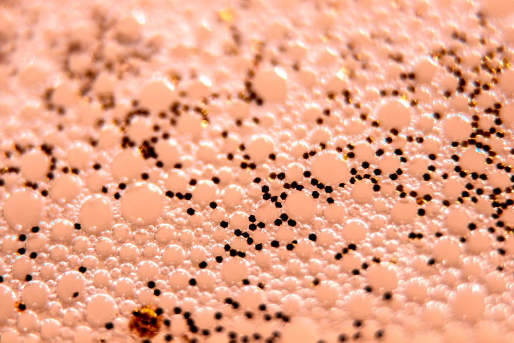 Bagaimana Penanganan Pori-Pori Tersumbat agar Kulit Tetap Sehat?